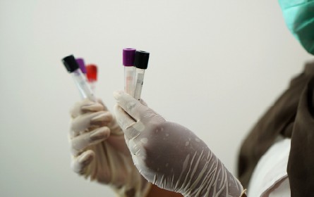 What Bio-buffers and Bio-detergents are suitable for the purification process of viral vectors?